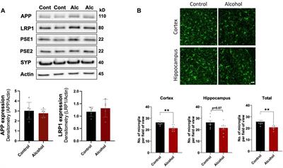Modulation of hepatic amyloid precursor protein and lipoprotein receptor-related protein 1 by chronic alcohol intake: Potential link between liver steatosis and amyloid-β